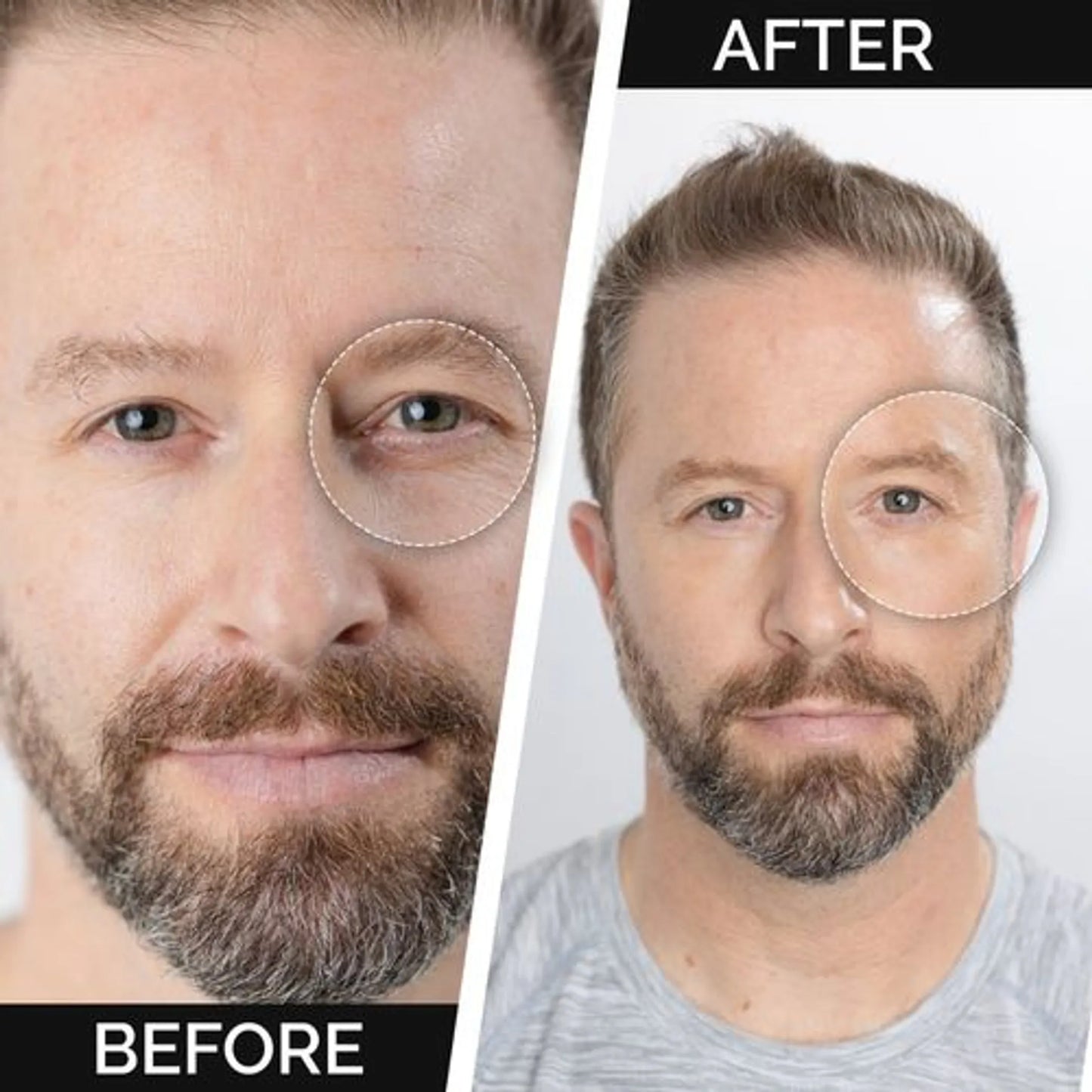 URBAN CAMOUFLAGE Concealer Stick for Men